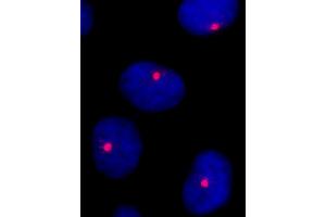 anti-Centrosomal Protein of 131 kDa (CEP131) (AA 1033-1083) antibody