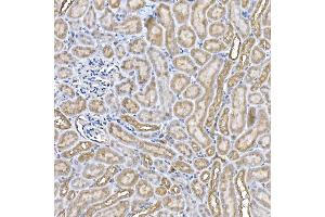 Immunohistochemistry of paraffin-embedded mouse kidney using Niemann Pick C1 Rabbit mAb (ABIN7268911) at dilution of 1:50 (40x lens).