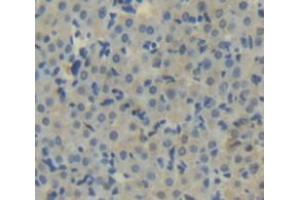 IHC-P analysis of Human Tissue, with DAB staining. (Aconitase 1 antibody  (AA 251-443))