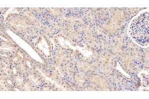 Detection of Tie1 in Human Kidney Tissue using Monoclonal Antibody to Tyrosine Kinase With Immunoglobulin Like And EGF Like Domains Protein 1 (Tie1) (TIE1 antibody  (AA 701-898))
