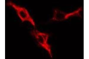 ABIN6276412 staining HepG2 cells by IF/ICC. (PRKAR1A antibody  (N-Term))