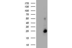 Image no. 2 for anti-Ubiquitin-Conjugating Enzyme E2E 3 (UBE2E3) antibody (ABIN1501622) (UBE2E3 antibody)