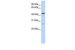 Image no. 1 for anti-Acyl-CoA Binding Domain Containing 5 (ACBD5) (AA 362-411) antibody (ABIN6739190) (ACBD5 antibody  (AA 362-411))