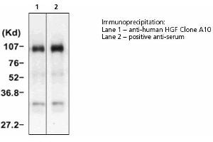 Image no. 1 for anti-Hepatocyte Growth Factor (Hepapoietin A, Scatter Factor) (HGF) antibody (ABIN331456)