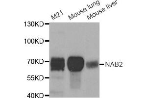 Western blot analysis of extracts of various cell lines, using NAB2 antibody (ABIN5973441) at 1/1000 dilution. (NAB2 antibody)