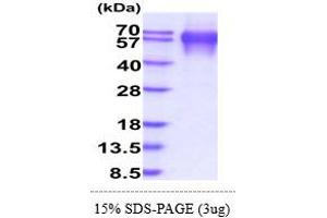 SDS-PAGE (SDS) image for Lysosomal-Associated Membrane Protein 1 (LAMP1) (AA 29-382) protein (His tag) (ABIN5855031)
