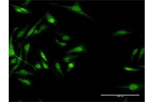 Immunofluorescence (IF) image for anti-Calcium Channel, Voltage-Dependent, beta 3 Subunit (CACNB3) (AA 1-484) antibody (ABIN947634)