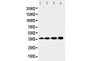 Anti-HSD17B1 antibody, Western blotting Lane 1: Rat Kidney Tissue Lysate Lane 2: Rat Liver Tissue Lysate Lane 3: 293T Cell Lysate Lane 4: HELA Cell Lysate (HSD17B1 antibody  (N-Term))