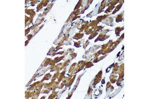 Immunohistochemistry (IHC) image for anti-Thioredoxin-Related Transmembrane Protein 2 (TMX2) (AA 128-296) antibody (ABIN7270810)