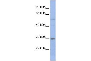 Host:  Rabbit  Target Name:  STEAP1B  Sample Type:  Fetal Small Intestine lysates  Antibody Dilution:  1. (STEAP1B antibody  (N-Term))