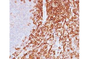 IHC staining of spleen with CD43 antibody (DF-T1). (CD43 antibody)