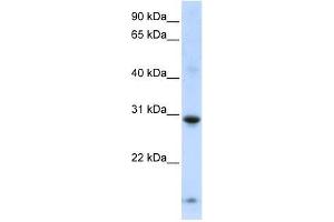 Western Blot showing ZNF138 antibody used at a concentration of 1-2 ug/ml to detect its target protein. (ZNF138 antibody  (Middle Region))