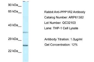 Western Blotting (WB) image for anti-Protein Phosphatase 1, Regulatory (Inhibitor) Subunit 2 (PPP1R2) (N-Term) antibody (ABIN2788785) (PPP1R2 antibody  (N-Term))