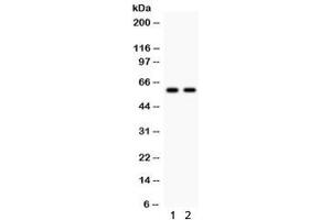 Western blot testing of 1) rat kidney and 2) human MCF7 lysate with CYP1B1 antibody. (CYP1B1 antibody  (AA 255-480))