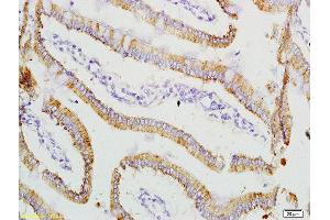 Formalin-fixed and paraffin embedded rat small intestine labeled with Anti-ADM2 Polyclonal Antibody, Unconjugated (ABIN682483) at 1:200 followed by conjugation to the secondary antibody and DAB staining (Adrenomedullin 2 antibody  (AA 75-148))