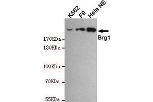 Western blot detection of BRG1 in Hela NE,F9 and K562 cell lysates using BRG1 mouse mAb (1:1000 diluted). (SMARCA4 antibody)