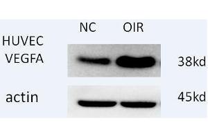 Western blot analysis of extracts of H460 cells, using antibody at 1:1000 dilution. (VEGFA antibody  (AA 1-147))