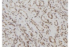 ABIN6272436 at 1/100 staining Human kidney tissue by IHC-P.