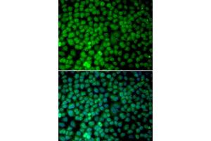 Immunofluorescence analysis of MCF7 cell using RBX1 antibody. (RBX1 antibody)