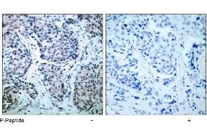 Image no. 1 for anti-Mitogen-Activated Protein Kinase Kinase 4 (MAP2K4) (pThr261) antibody (ABIN196908) (MAP2K4 antibody  (pThr261))