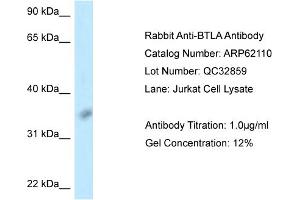 Western Blotting (WB) image for anti-B and T Lymphocyte Associated (BTLA) (Middle Region) antibody (ABIN2789022) (BTLA antibody  (Middle Region))