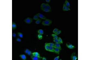 Immunofluorescent analysis of HepG2 cells using ABIN7168896 at dilution of 1:100 and Alexa Fluor 488-congugated AffiniPure Goat Anti-Rabbit IgG(H+L) (SPTLC2 antibody  (AA 88-562))