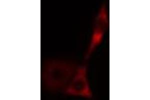 ABIN6269010 staining HeLa cells by IF/ICC. (HSPA9 antibody  (C-Term))