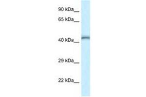 Image no. 1 for anti-TEA Domain Family Member 4 (TEAD4) (AA 100-149) antibody (ABIN6747514) (TEAD4 antibody  (AA 100-149))