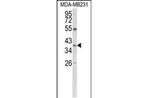 Western blot analysis of ARG1 Antibody in MDA-MB231 cell line lysates (35ug/lane) (Liver Arginase antibody  (C-Term))
