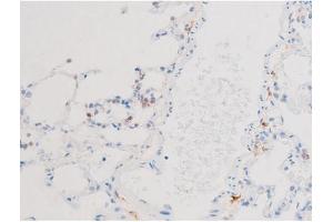 ABIN6267576 at 1/200 staining Rat lung tissue sections by IHC-P. (Smad2/3 antibody  (pThr8, Thr8))