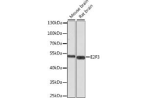 Western blot analysis of extracts of various cell lines, using E2F3 antibody (ABIN6134586, ABIN6139901, ABIN6139902 and ABIN7101833) at 1:1000 dilution. (E2F3 antibody  (AA 200-300))