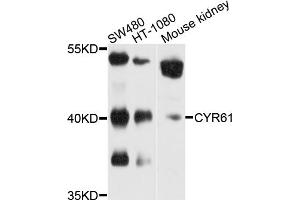 Western blot analysis of extracts of various cell lines, using CYR61 antibody (ABIN5970462) at 1/1000 dilution.