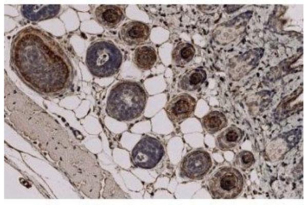 Trichohyalin antibody