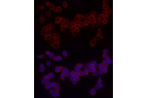 Immunofluorescence analysis of THP-1 cells using CD18 Rabbit pAb (ABIN3023117, ABIN3023118, ABIN3023119 and ABIN6219398) at dilution of 1:50 (40x lens). (Integrin beta 2 antibody  (AA 70-170))