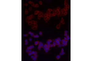 Immunofluorescence analysis of THP-1 cells using CD18 Rabbit pAb (ABIN3023117, ABIN3023118, ABIN3023119 and ABIN6219398) at dilution of 1:50 (40x lens). (Integrin beta 2 antibody  (AA 70-170))