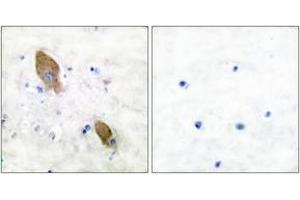 Immunohistochemistry analysis of paraffin-embedded human brain, using PYK2 (Phospho-Tyr881) Antibody. (PTK2B antibody  (pTyr881))