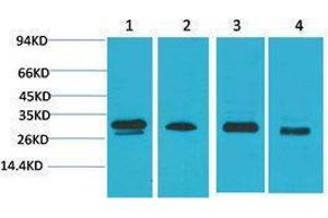 Western Blotting (WB) image for anti-Protein Kinase, AMP-Activated, beta 2 Non-Catalytic Subunit (PRKAB2) antibody (ABIN3179113) (PRKAB2 antibody)