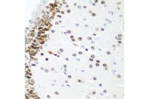 Immunohistochemistry of paraffin-embedded mouse brain using UBE2U antibody at dilution of 1:100 (40x lens). (UBE2U antibody)