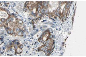 ABIN6276478 at 1/100 staining Human prostate tissue by IHC-P.