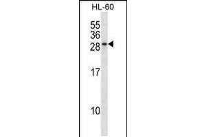 Western blot analysis in HL-60 cell line lysates (35ug/lane). (RAB15 antibody  (AA 105-133))