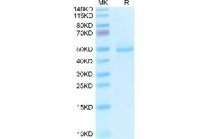 Human GP1BB on Tris-Bis PAGE under reduced condition. (GP1BB Protein (AA 27-147) (Fc Tag))