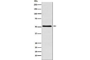Western blot analysis of BAF57/SMARCE1 expression in Raji cell lysate.