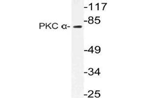 Western blot (WB) analysis of PKC alpha antibody in extracts from Jurkat cells.
