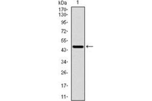 Western Blotting (WB) image for anti-Ribosomal Protein S6 Kinase, 70kDa, Polypeptide 1 (RPS6KB1) antibody (ABIN1108904) (RPS6KB1 antibody)