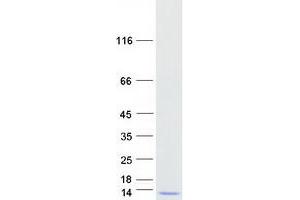 Validation with Western Blot (GTF2H5 Protein (Myc-DYKDDDDK Tag))