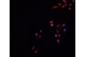 ABIN6269016 staining HeLa cells by IF/ICC. (Ku70/80 antibody)