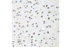 Immunohistochemistry of paraffin-embedded mouse brain using AGO2 antibody (ABIN5974124) at dilution of 1/100 (40x lens). (AGO2 antibody)