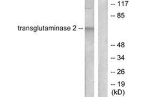Western blot analysis of extracts from HuvEc cells, using Transglutaminase 2 Antibody. (Transglutaminase 2 antibody  (AA 1-50))