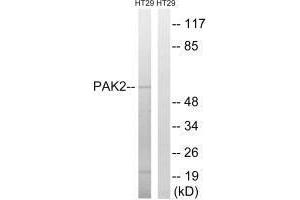 Western blot analysis of extracts from HT-29 cells, using PAK2 (Ab-197) antibody. (PAK2 antibody  (Ser62))