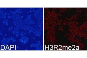 Immunofluorescence analysis of 293T cell using H3R2me2a antibody. (Histone 3 antibody  (H3R2me2a))